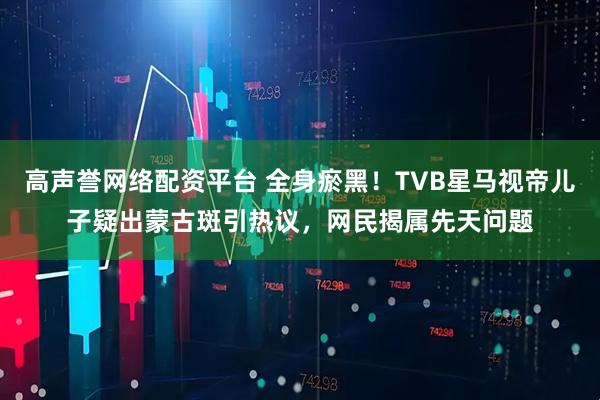 高声誉网络配资平台 全身瘀黑！TVB星马视帝儿子疑出蒙古斑引热议，网民揭属先天问题